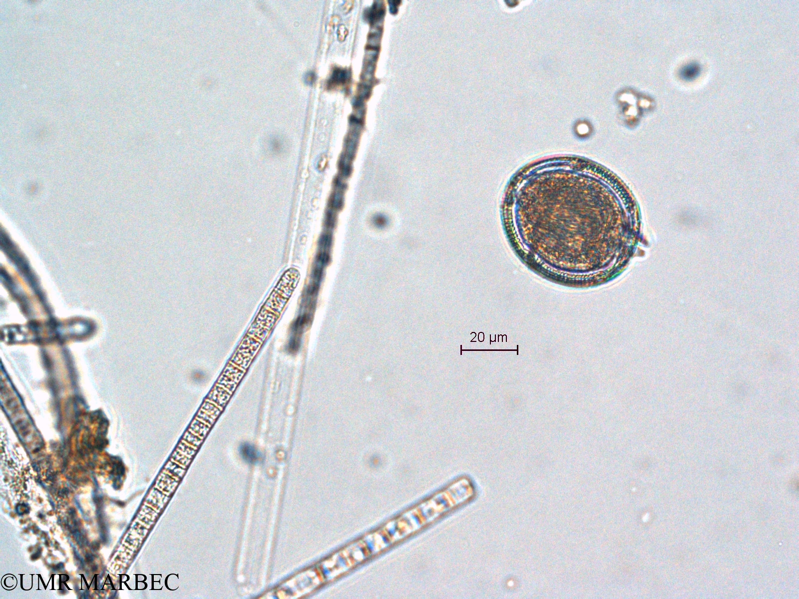 phyto/Scattered_Islands/all/COMMA April 2011/Blepharocysta sp3 (ancien Dino i cf Oblea, goniodoma ou lingulodinium -1)(copy).jpg